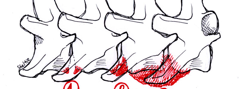 Spondylóza psa
