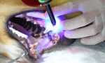 ultrazvukové odstránenie zubného kamena